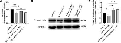Umbilical Cord Mesenchymal Stem Cells Ameliorate Kidney Injury in MRL/Ipr Mice Through the TGF-β1 Pathway